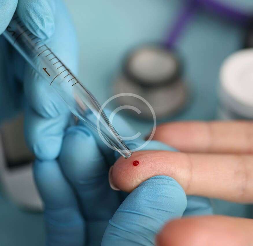 Blood test